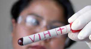 Zamora concentra el mayor número de casos de VIH en la región