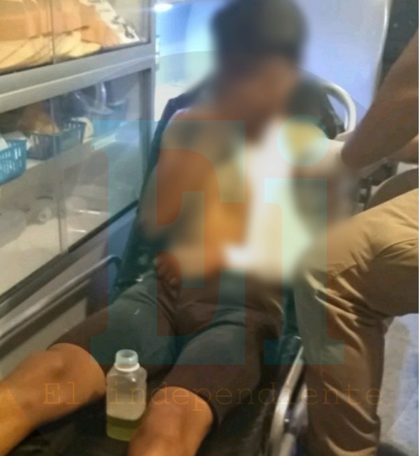 Menor de edad es herido a balazos en la Miguel Hidalgo