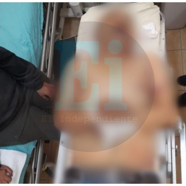 Quincuagenario muere en hospital tras ser baleado en Los Sabinos