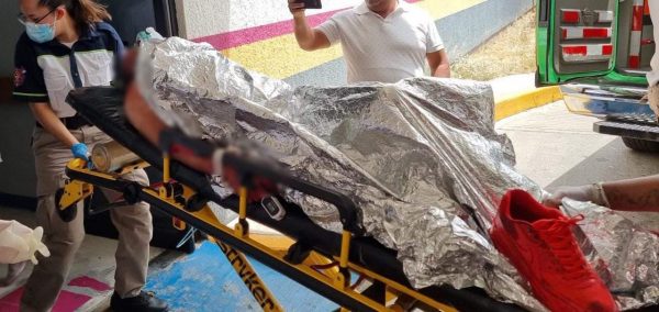Adolescente muere en un hospital, tras ser baleado en El Porvenir